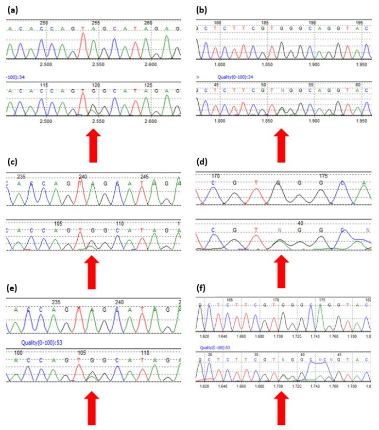 【佳学基因检测】3β-羟基类固醇脱氢酶缺陷症基因解码、基因检测