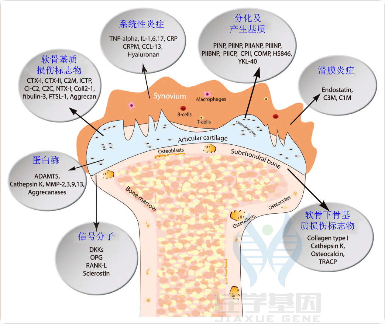 【佳学基因检测】骨关节炎基于基因检测的分子诊断分型