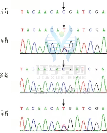 DVL1突变检测应该包括多少位点